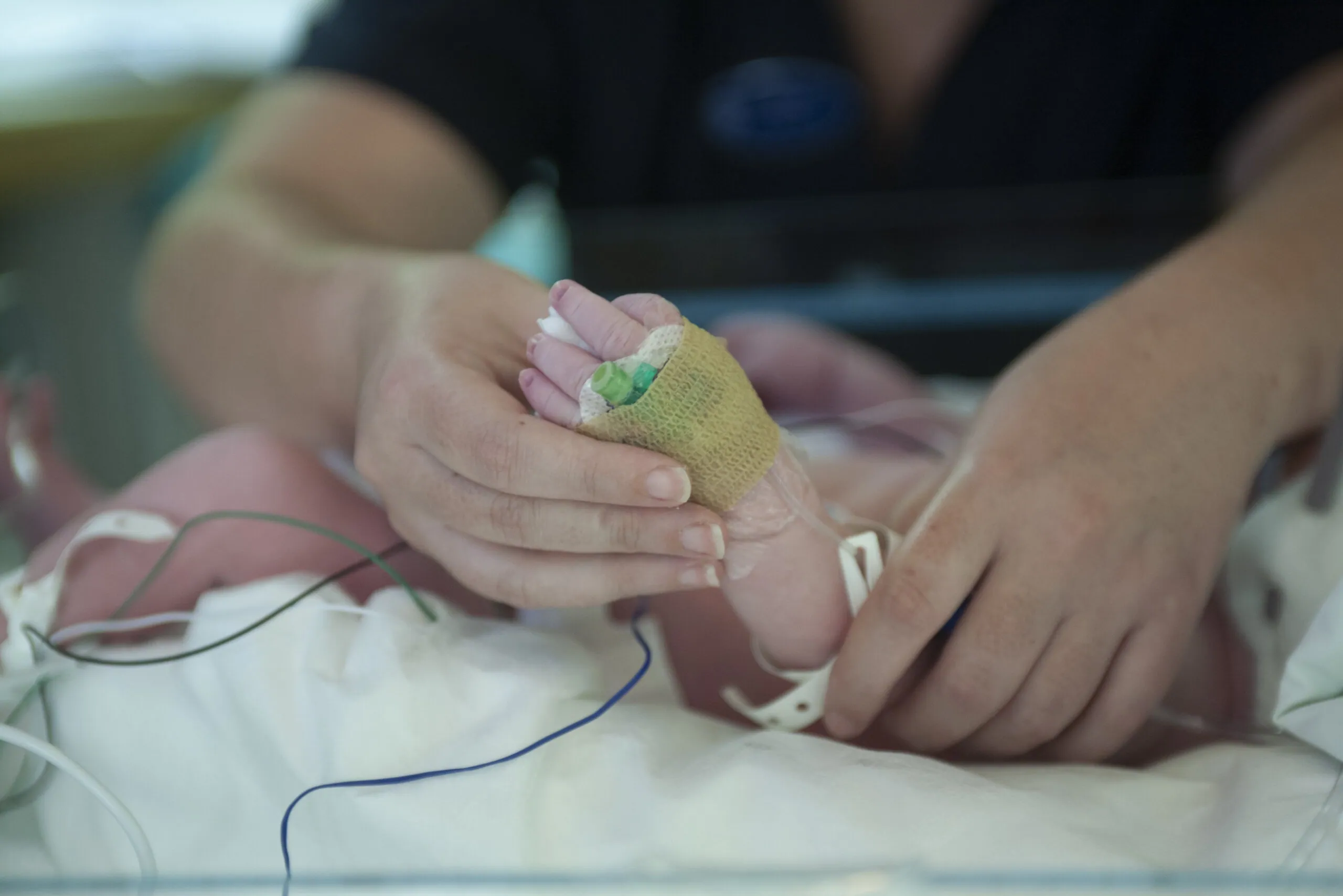 baby with birth injury
